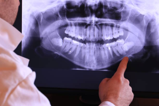 Best Orthodontic Emergency Dentist in Washburn, IL