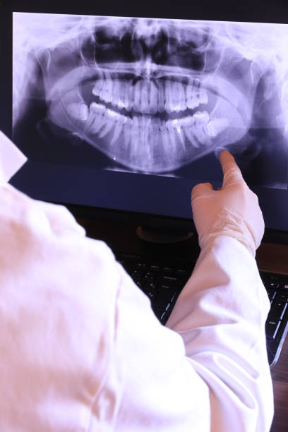 Best Emergency Root Canal Treatment in Washburn, IL