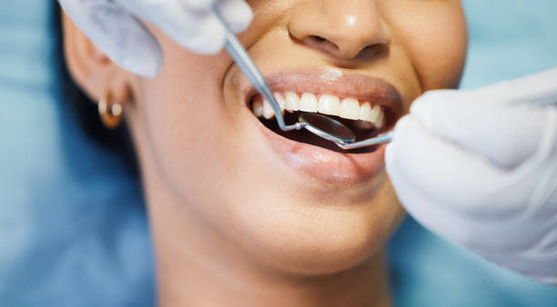 Best Emergency Cosmetic Dentistry in Washburn, IL